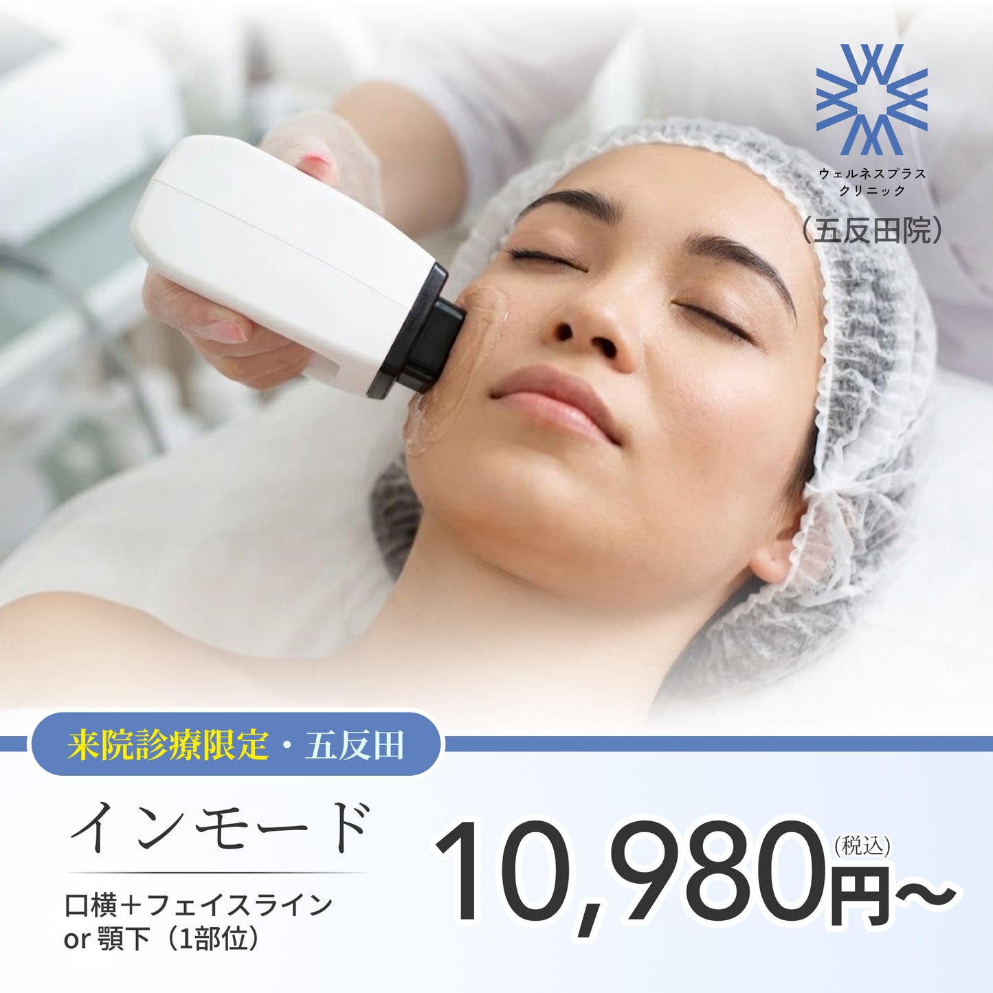 【Wellness Plus Clinic】ePass｜インモード｜口横＋フェイスライン or 顎下｜（1部位）