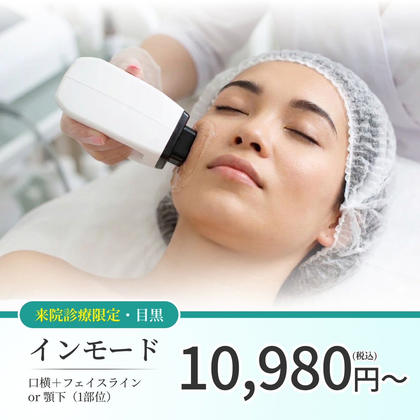 【Elifa Clinic】ePass｜インモード｜口横＋フェイスライン or 顎下｜（1部位）