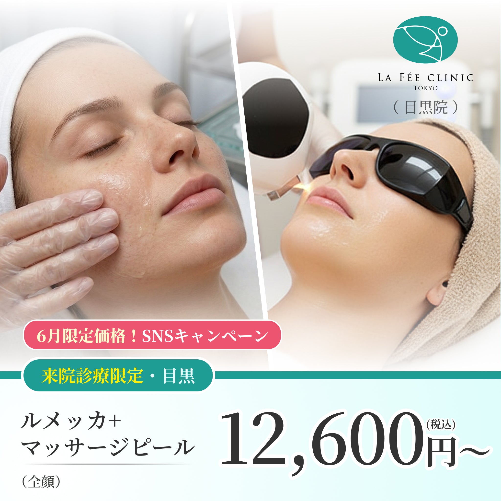 【La Fée Clinic】6月SNSキャンペーン｜ルメッカ＋マッサージピール