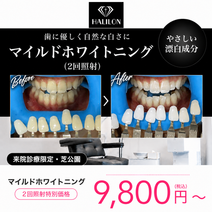 【HALILON Oral Studio】来院診療｜マイルドホワイトニングプラン(2回照射)