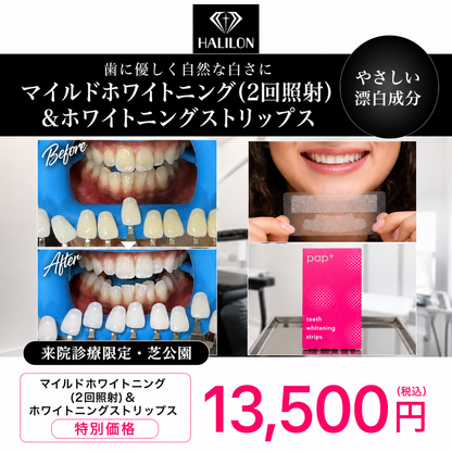 【HALILON Oral Studio】来院診療｜マイルドホワイトニングプラン(2回照射)