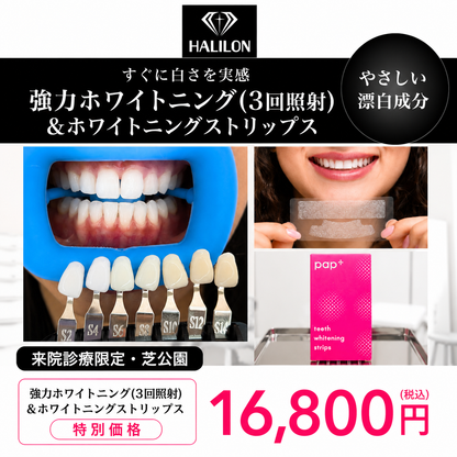 【HALILON Oral Studio】来院診療｜強力ホワイトニング(3回照射)プラン