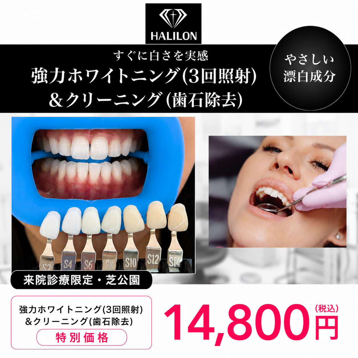 【HALILON Oral Studio】来院診療｜強力ホワイトニング(3回照射)プラン