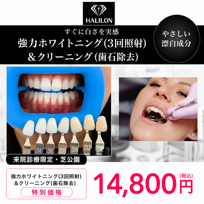 【HALILON Oral Studio】来院診療｜強力ホワイトニング(3回照射)プラン