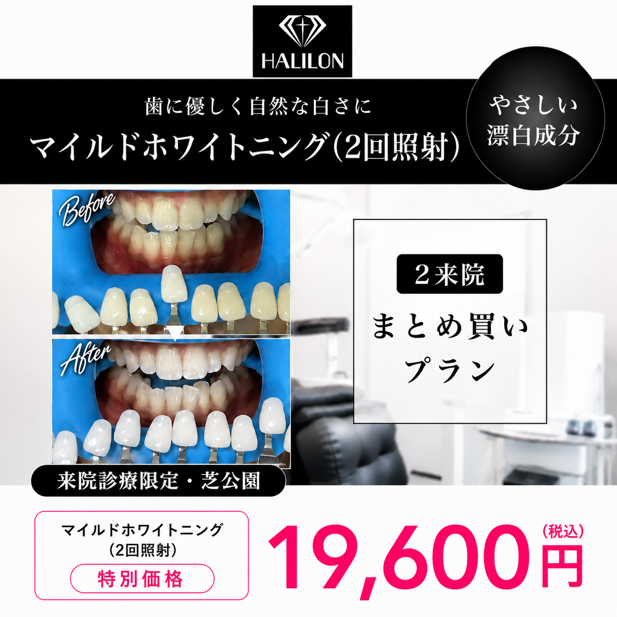 【HALILON Oral Studio】来院診療｜マイルドホワイトニングプラン(2回照射)